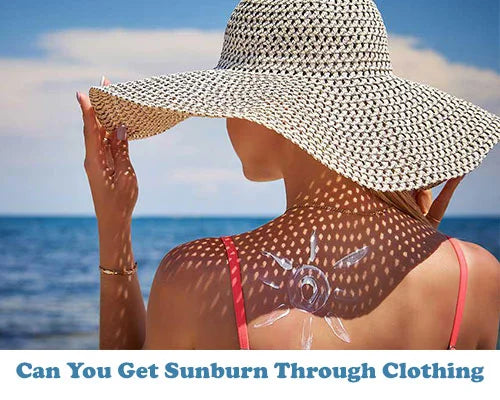 Can You Get Sunburn Through Clothing?